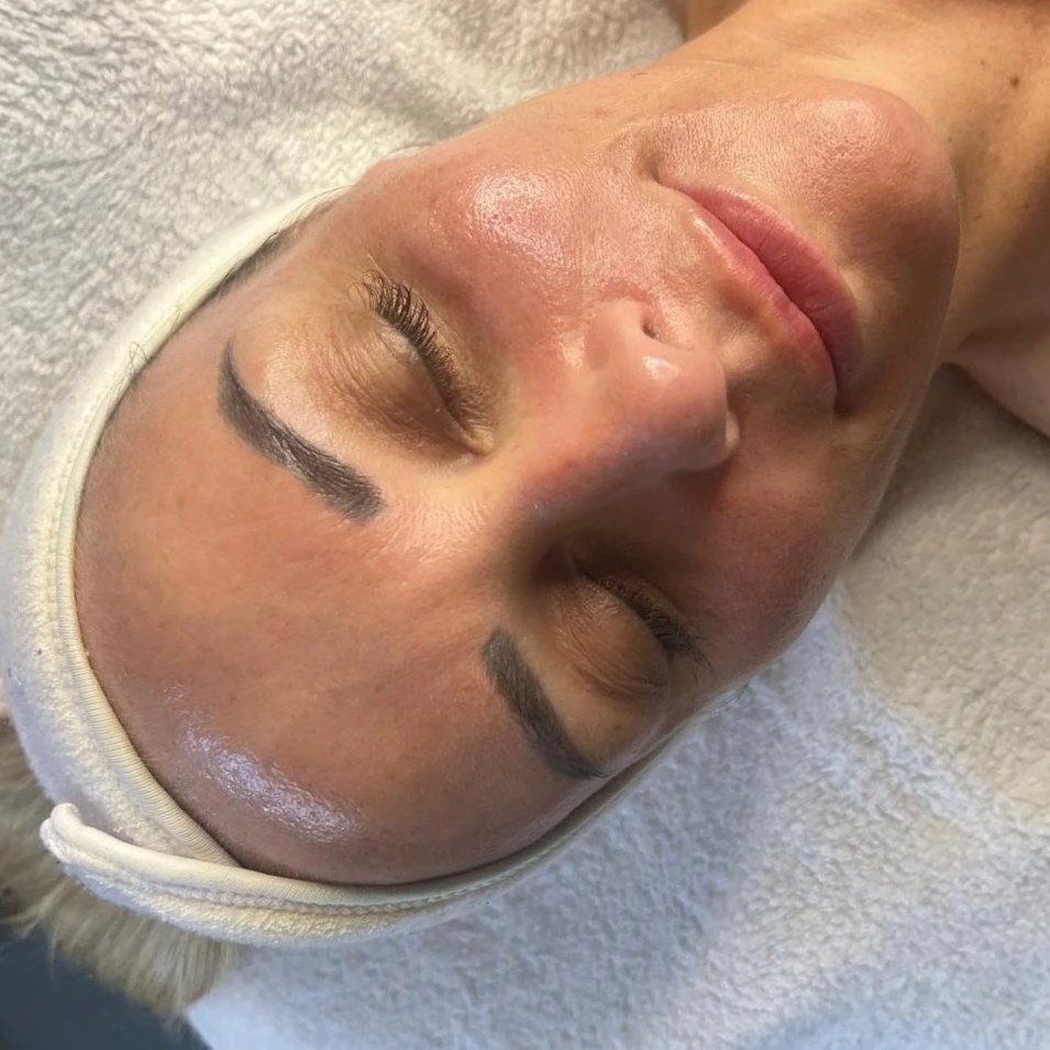 A woman lying down with her eyes closed, wearing a towel around her head, receiving a facial treatment in a spa or clinic setting.