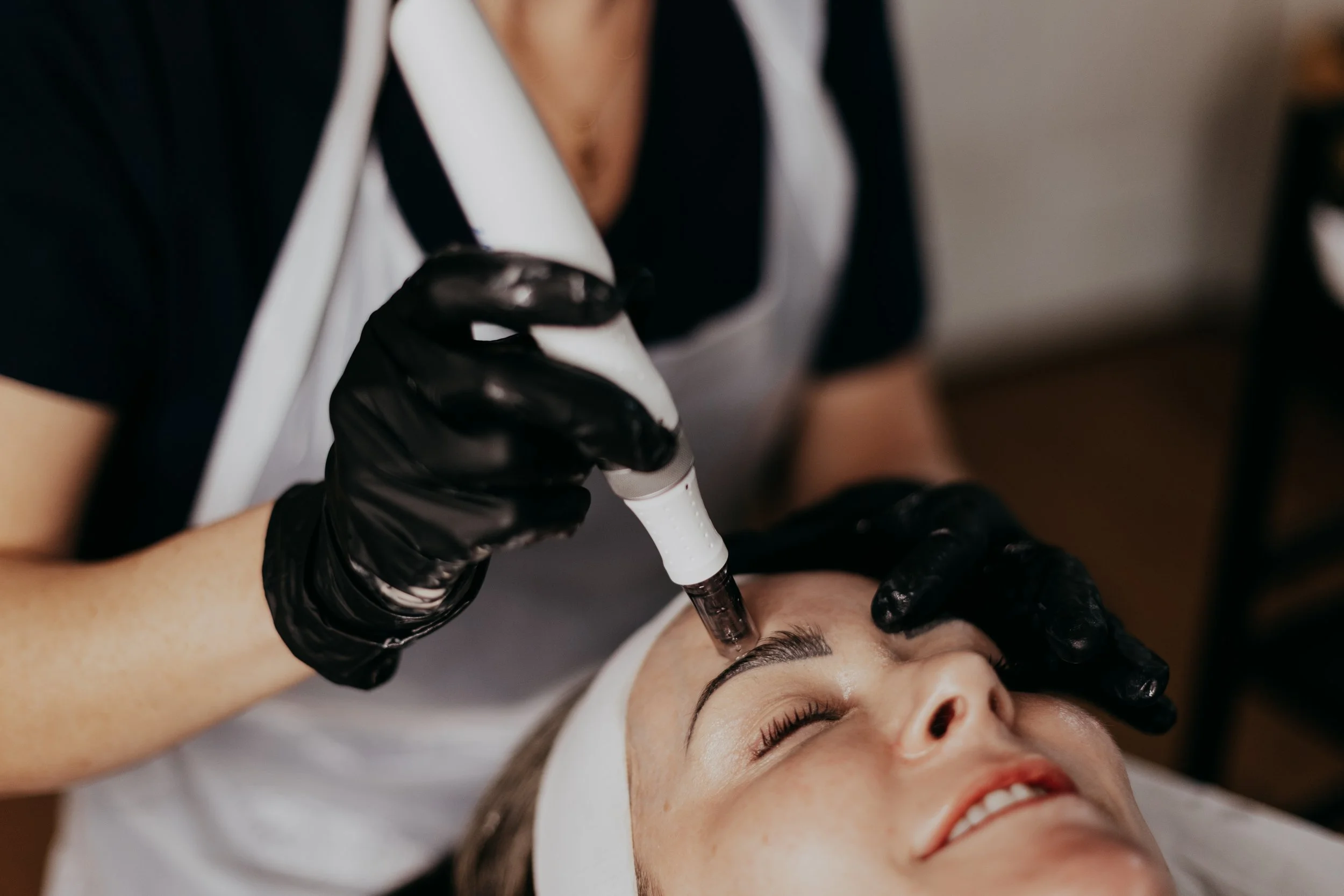Microneedling near Bournemouth