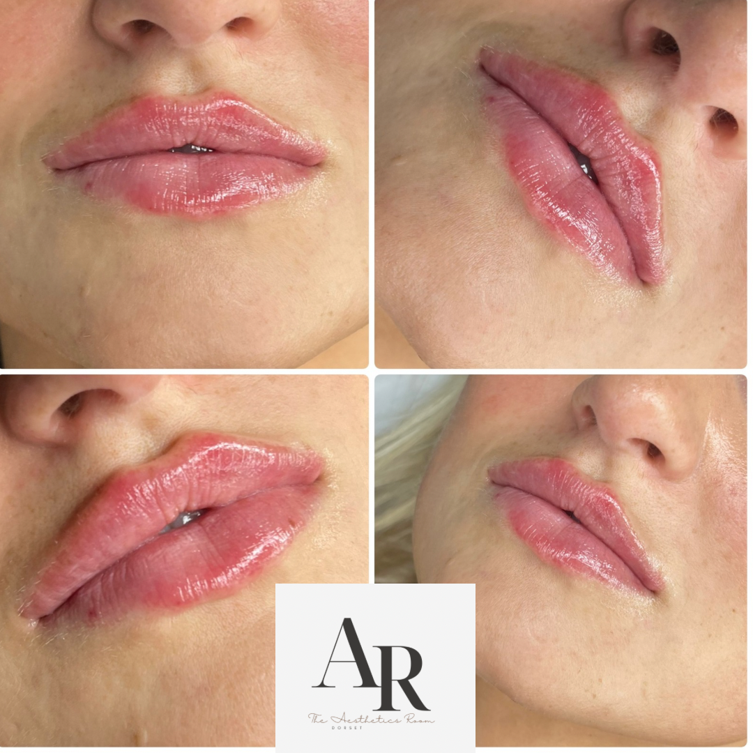 Untitled design - 1.png