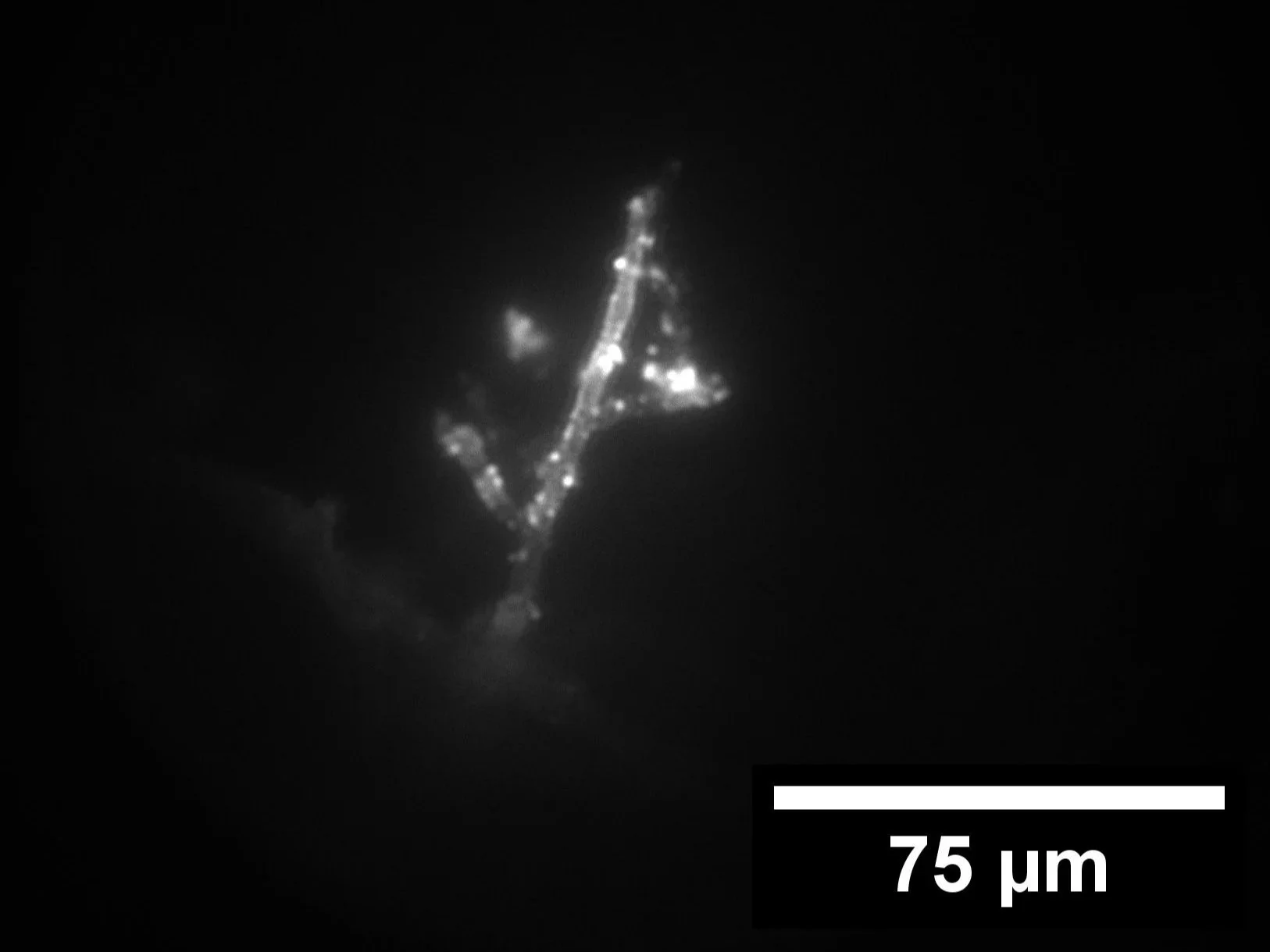 gdtests_spot3_roothair_adding_gd_before_fl2 with scale.jpg