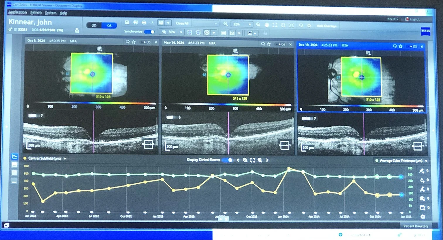 Composite scan of three different injection visits.