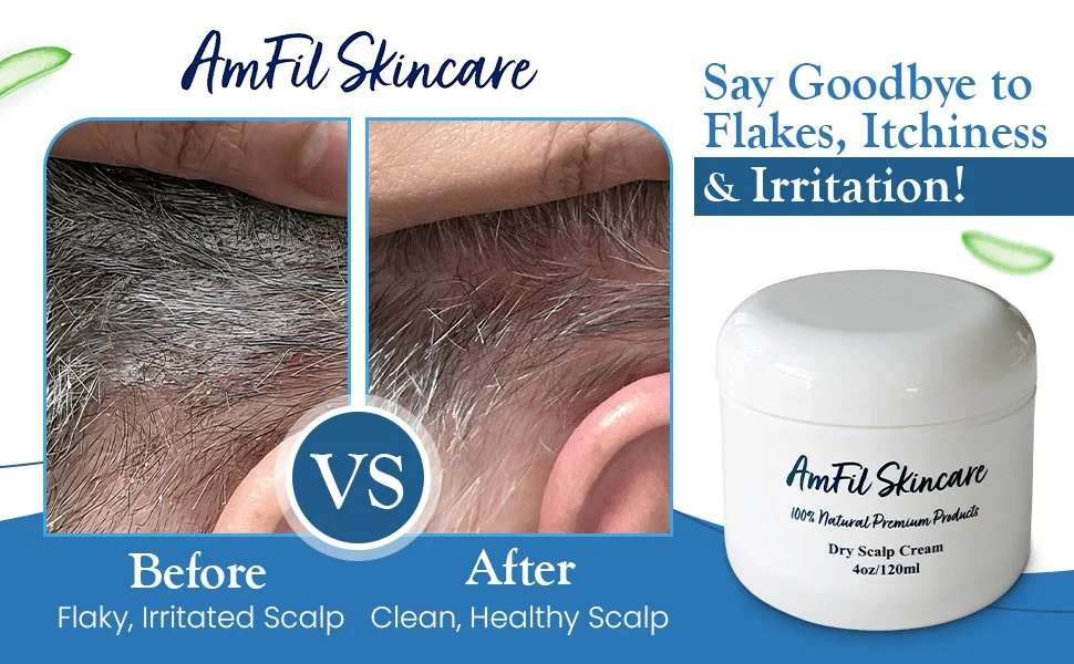 Flaky irritated scalp, clean healthy scalp