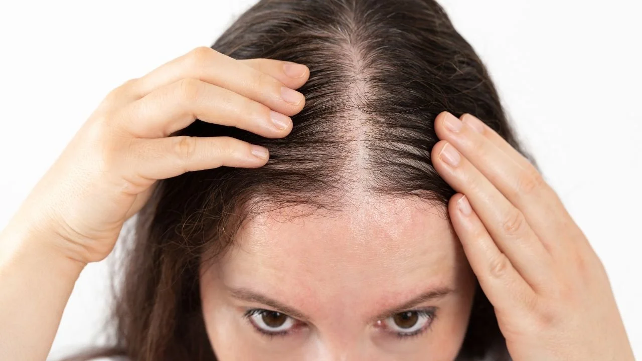 How to Stop Hair Loss and Regrow Hair Naturally 