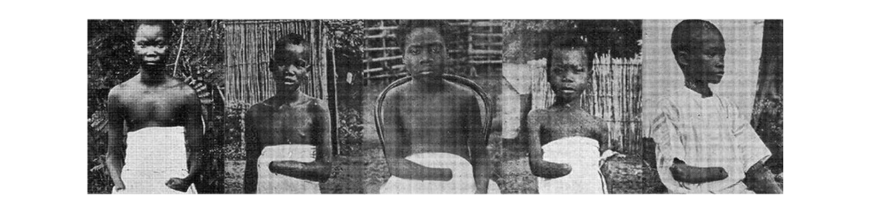 Five young children standing outdoors with a wooden fence and trees in the background. They are wearing white cloths around their waists.