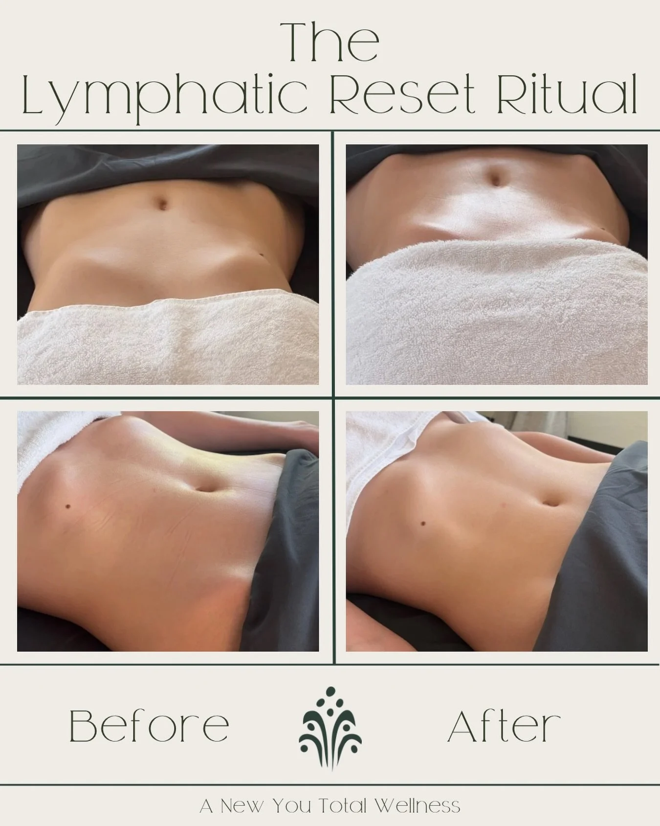 This isn&rsquo;t weight loss.
This is fluid.
And this is the difference it can make after just one session.
If you&rsquo;ve been feeling:
 &bull; puffy
 &bull; bloated
 &bull; heavy
 &bull; or just &ldquo;off&rdquo; in your body
this is exactly what 