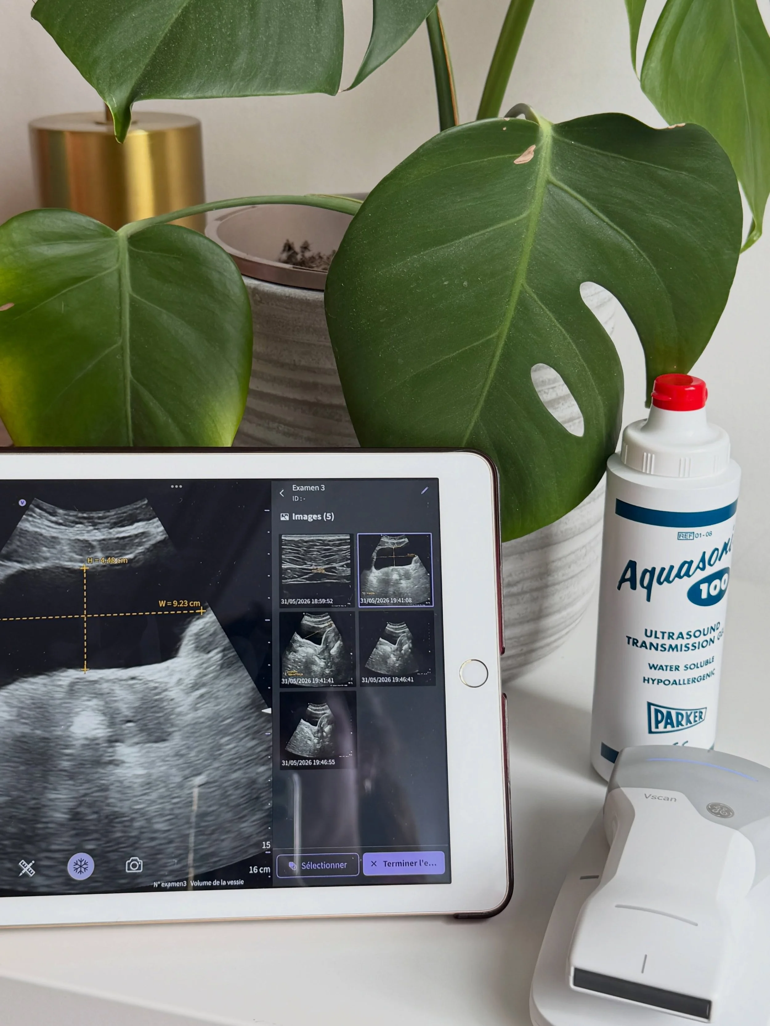 WHY I INVESTED IN ULTRASOUND IMAGING 🦊👀

As a pelvic health physiotherapist, ultrasound is not a diagnostic tool in my hands, but it is an incredible tool for assessment, education and rehabilitation.

Why I added it to my practice:

➡️ Real-time v