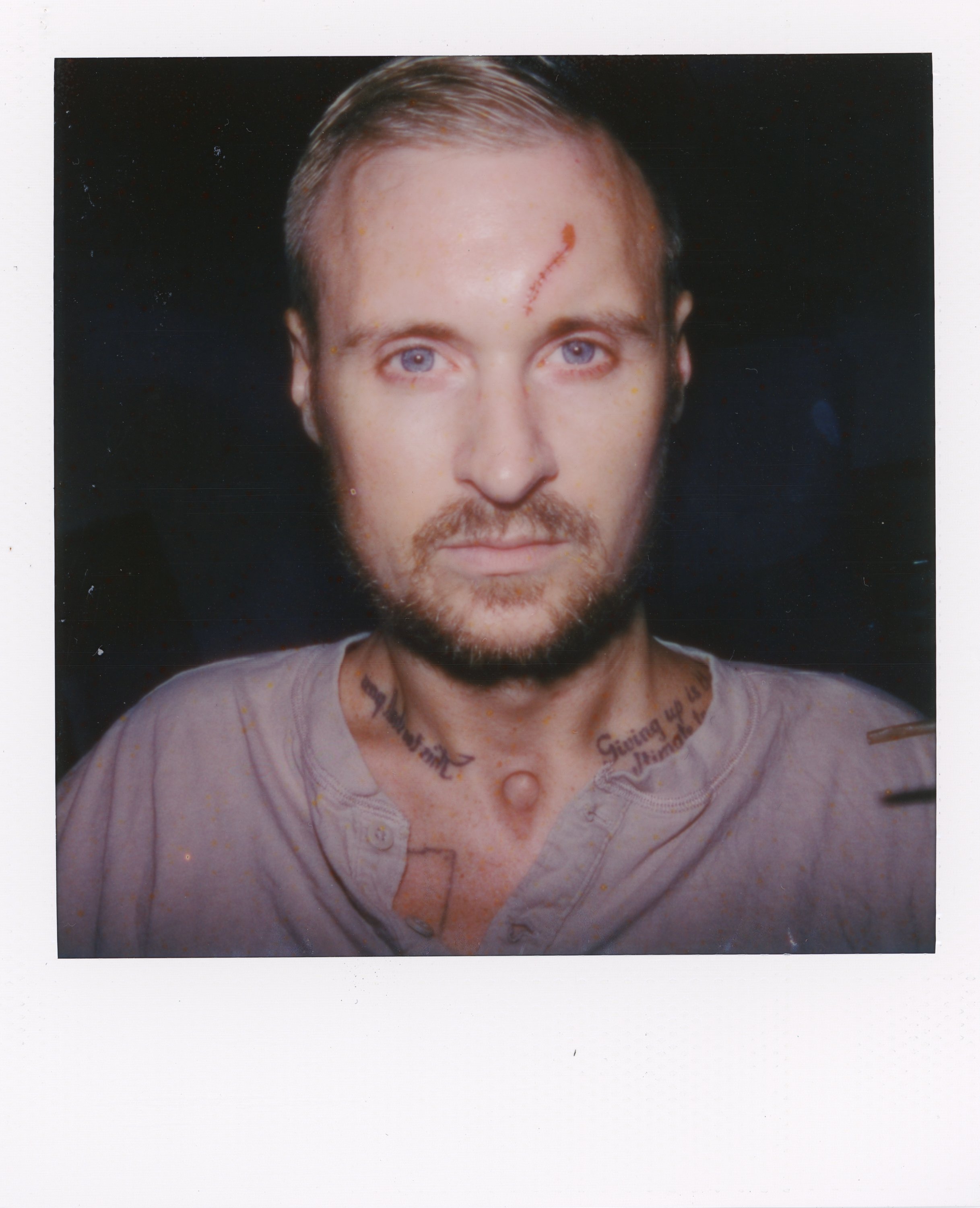 A young man with blonde hair, blue eyes, and a beard, facing directly towards the camera. He has a visible scar on his forehead and a tattoo around his neck. The background is dark.