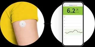 A person wearing a yellow shirt with a wearable glucose monitor on their arm, connected to a smartphone displaying blood sugar levels of 6.2.