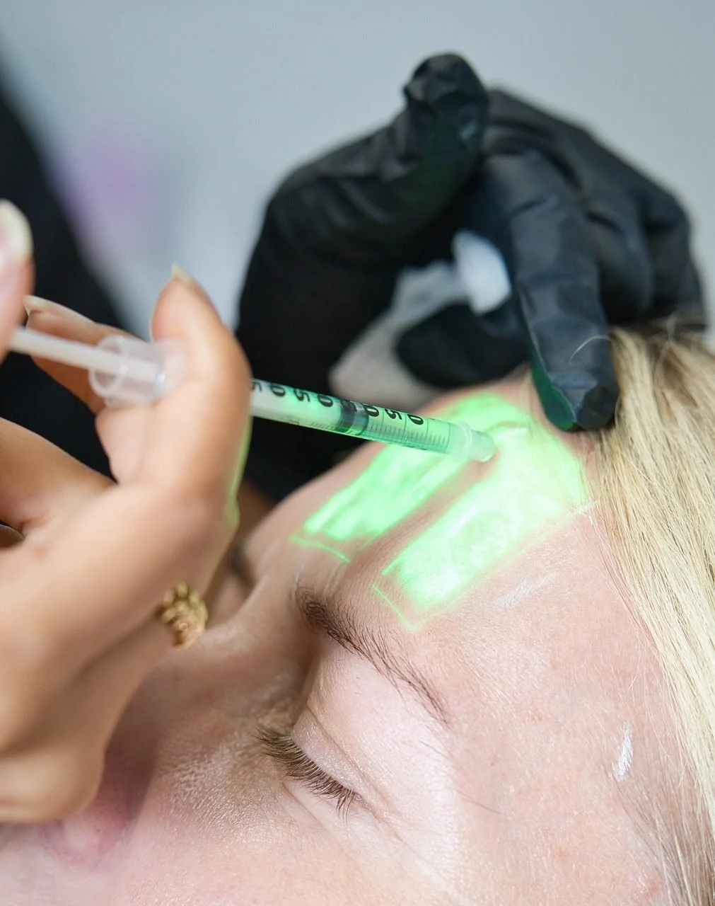 Person getting Botox in the forehead at a med spa in Houston
