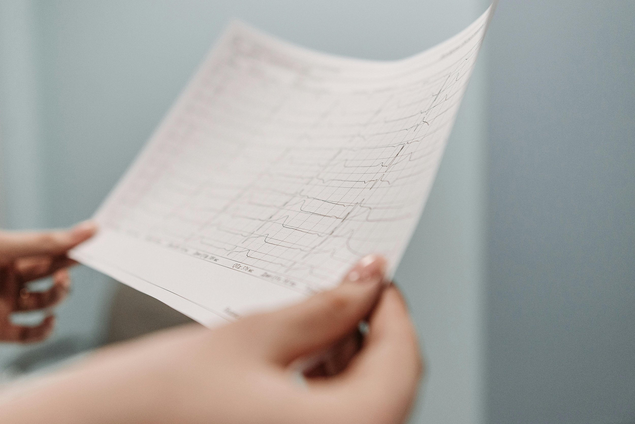 Person holding a paper with an electrocardiogram (ECG) printout.