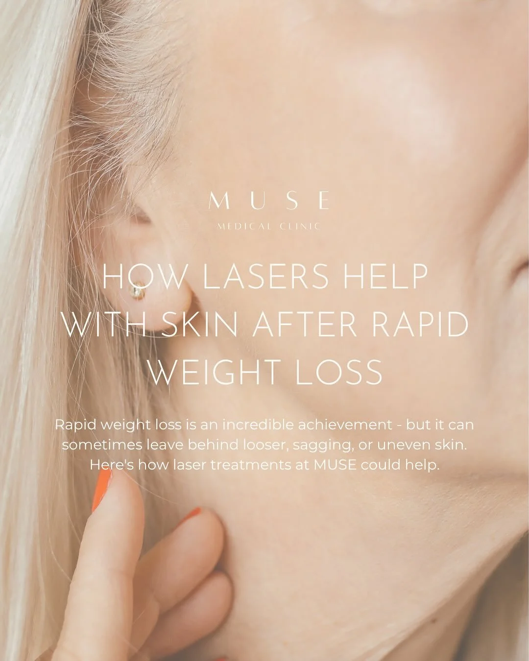 How Lasers Help with Skin After Rapid Weight Loss ✨⁠
⁠
Rapid weight loss is an incredible achievement - but it can sometimes leave behind looser, sagging, or uneven skin. This happens as the skin struggles to contract at the same pace as the body, le