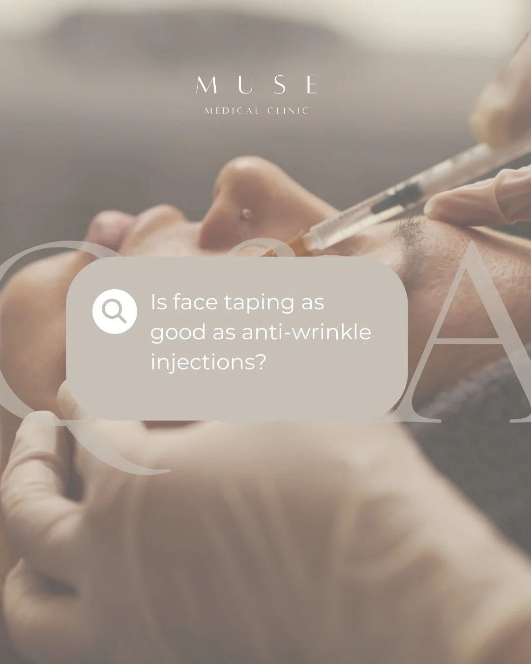 Face taping has become a popular trend, but how does it really compare to anti-wrinkle injections?⁠
⁠
✨ Face taping⁠
May temporarily smooth the appearance of fine lines by restricting movement overnight. Results are short-lived and largely cosmetic.⁠
