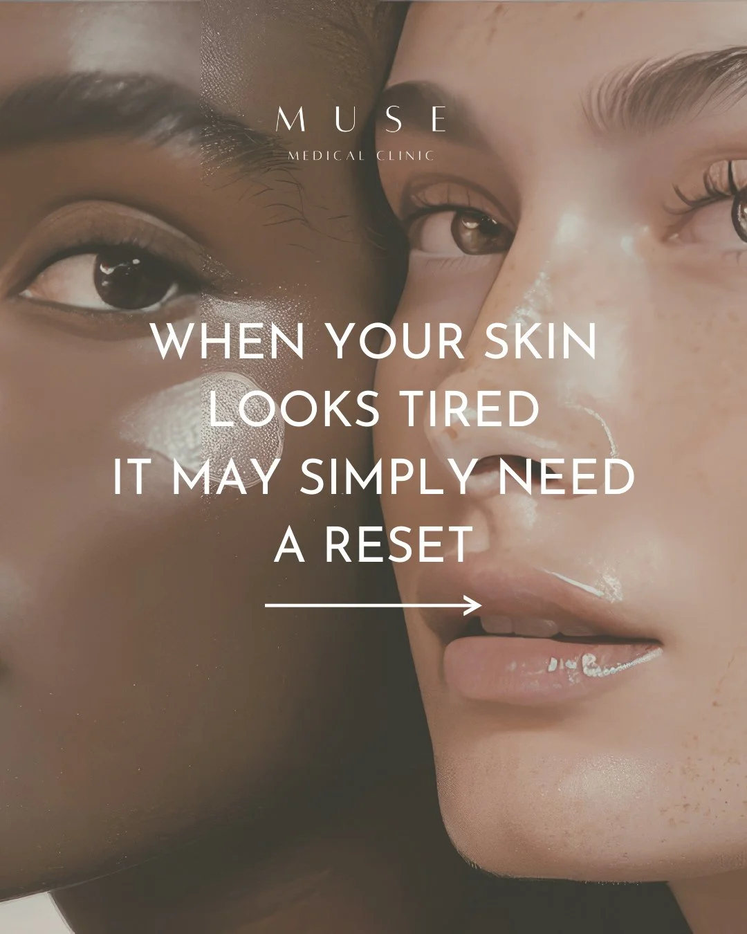 Not every skin concern requires an injectable or laser treatment.⁠
⁠
Sometimes skin simply needs the right combination of cleansing, exfoliation, and hydration to restore balance.⁠
⁠
The MUSE Glow Facial is designed to refresh dull skin, improve hydr