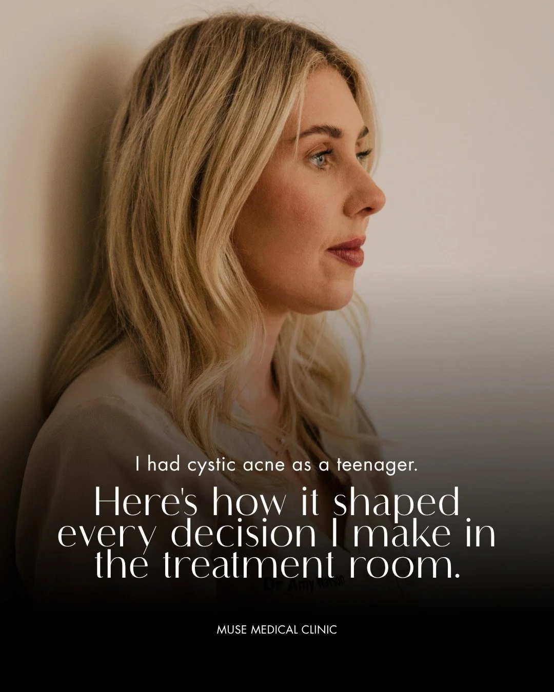 I became a better aesthetic doctor because of my own skin. As a teenager, I suffered from severe cystic acne and went through a course of Roaccutane. Later, during my pregnancies and afterwards, I dealt with psoriasis on my face. Neither experience w