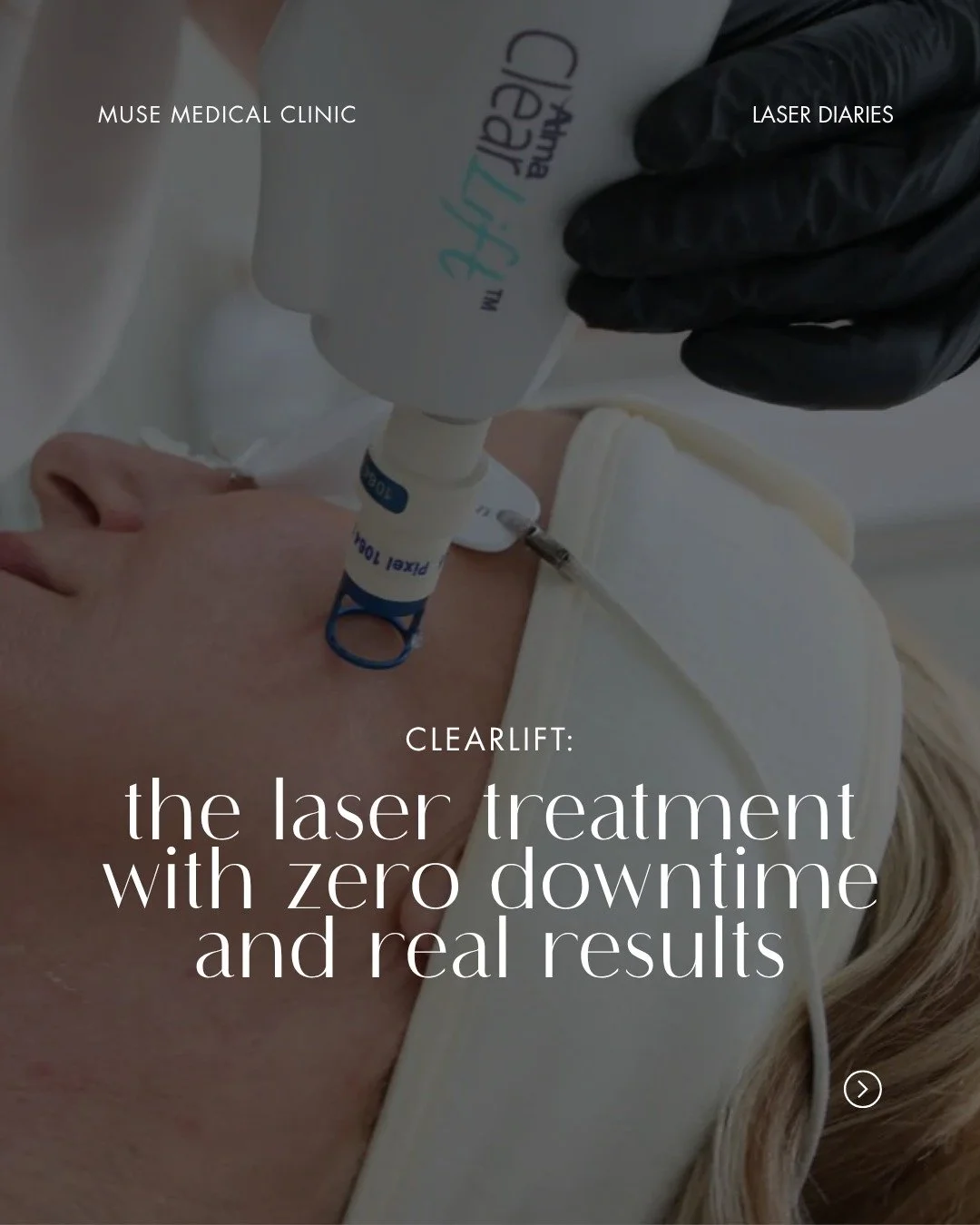 If the idea of laser puts you off because of downtime, ClearLift was designed for you.

It's one of our most popular treatments at MUSE, and honestly, one of the most underappreciated in aesthetics generally.

ClearLift is a non-ablative laser delive