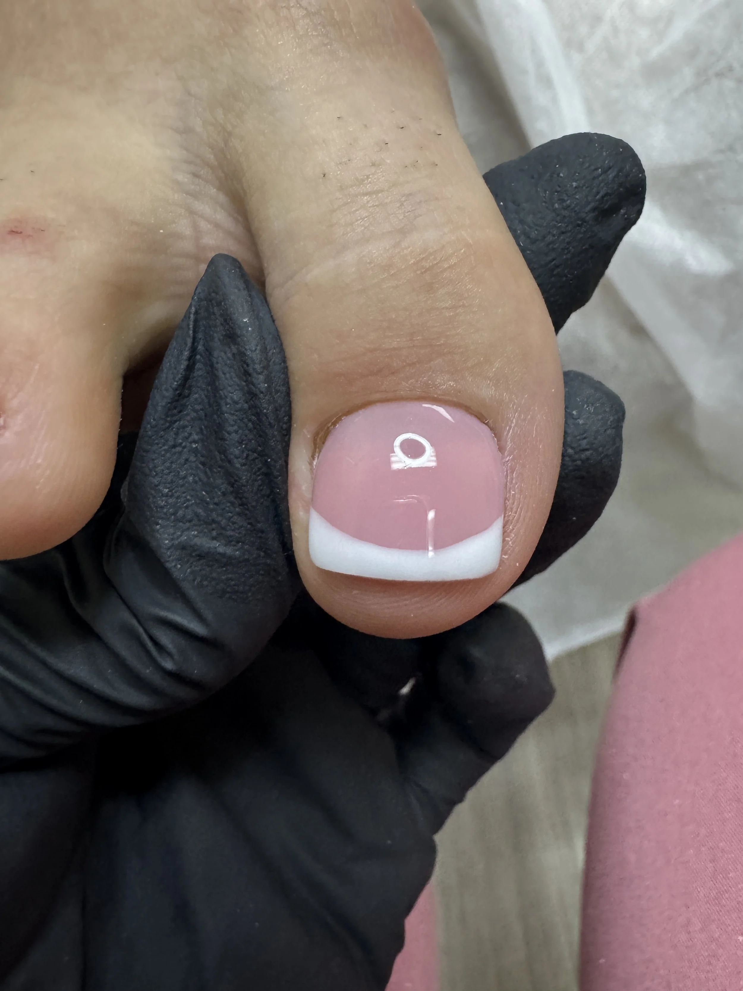 Toenail reconstruction with french after.JPG