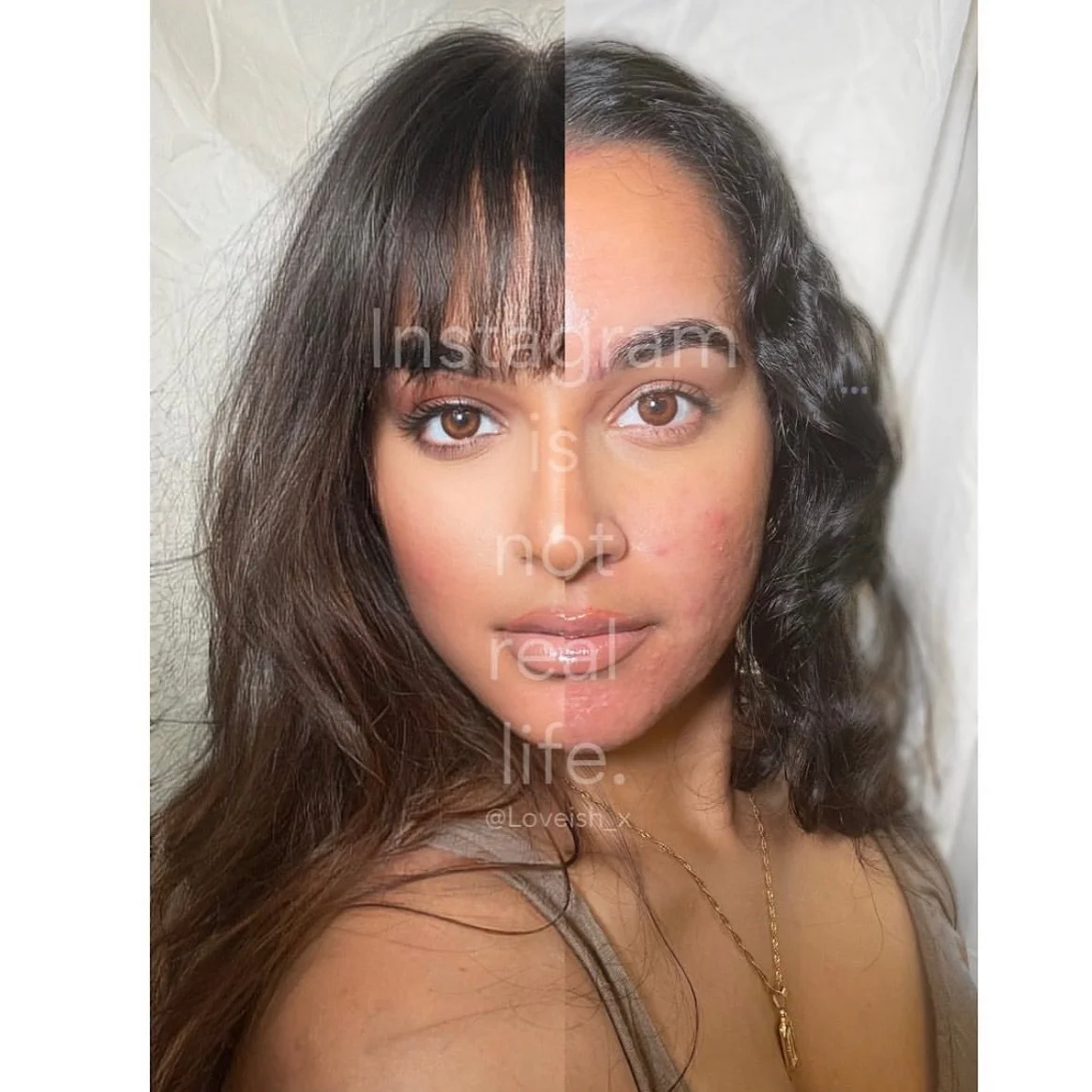 5 years ago, I posted my first photo with acne. 

I had always felt more comfortable behind a camera then in front of it. An act that I thought would help me learn to love my imperfections led to something much bigger&hellip; it inspired those around