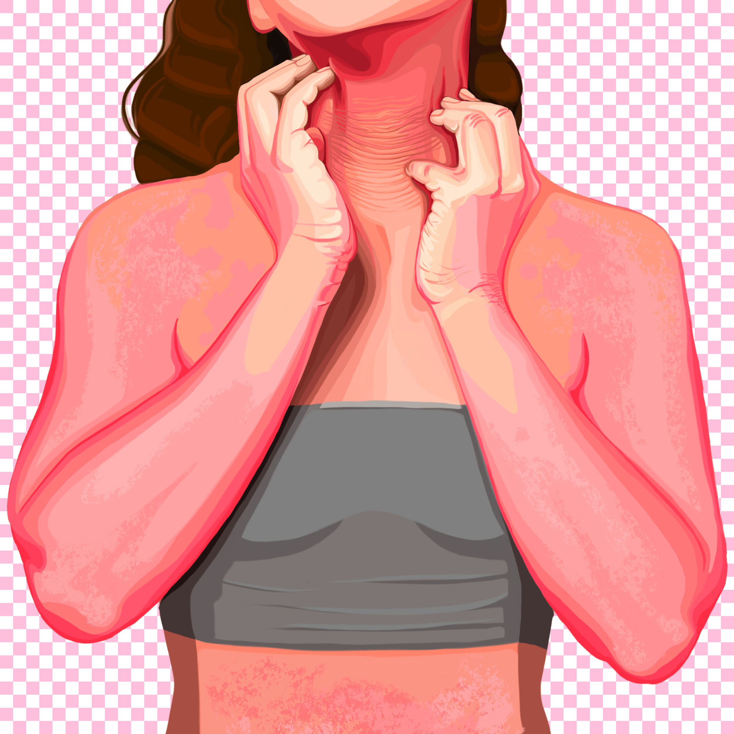 Illustration of a woman with inflamed, eczema and tsw prone skin touching her neck and chin, wearing a gray sports bra, with a pink checkered background.
