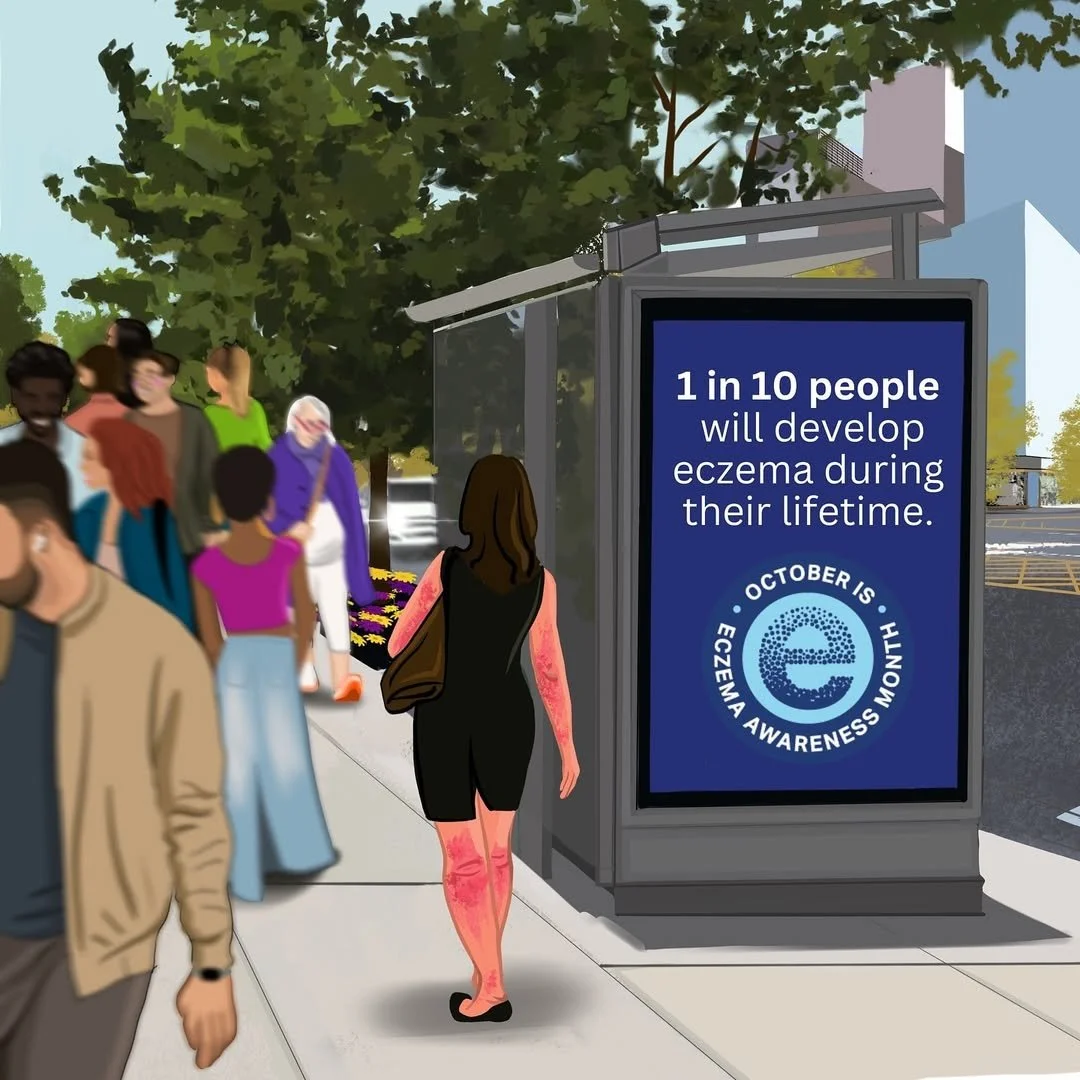 1 in 10 people will develop eczema during their lifetime, a woman with eczema flares walking in the street