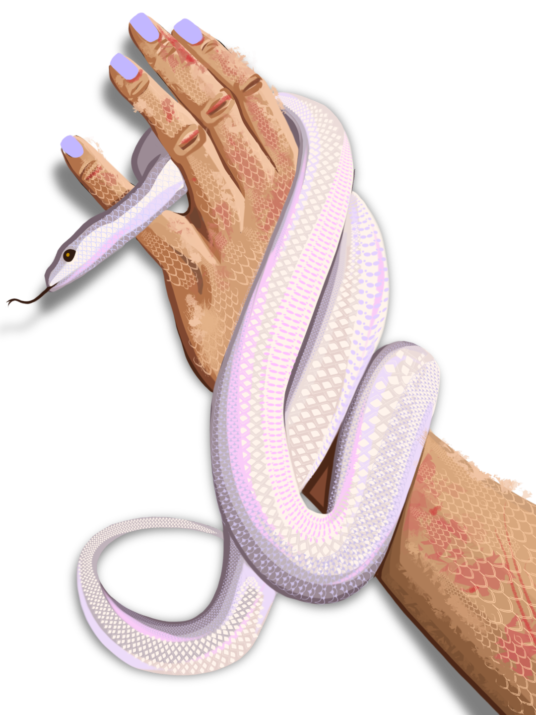 Neuro Dermatitis