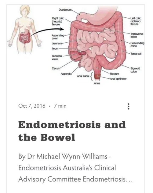 Diagram of the human digestive system highlighting the large and small intestines, including parts like the duodenum, ileocecal valve, cecum, appendix, colon, rectum, and anus.
