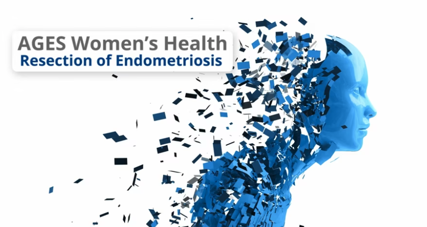 Digital illustration of a woman's profile dissolving into small blue squares, representing health and medical theme, related to endometriosis resection.