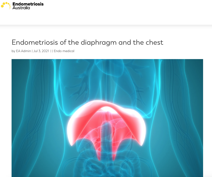 Digital illustration of the internal male reproductive organs, highlighting the diaphragm and chest area with a focus on endometriosis.