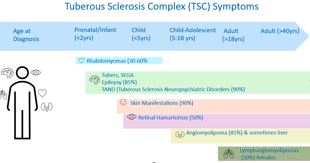 A chart listing symptoms of Tuberous Sclerosis Complex (TSC) across different age groups, with icons representing the brain, eye, heart, skin, eye, and lungs.