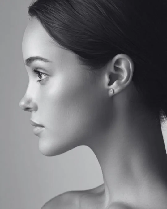 Profile view of a woman with defined jawline, smooth neck, and lifted midface — typical results following facelift surgery.