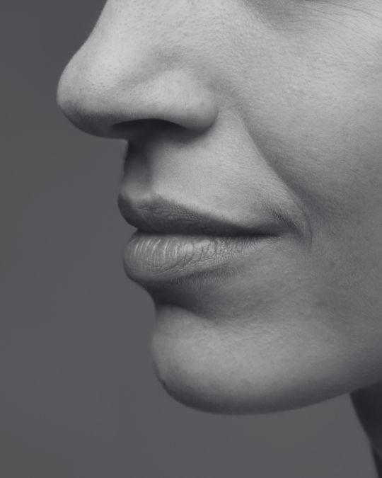 Close-up of the lower face showing skin laxity and nasolabial folds, commonly addressed with facelift surgery to restore a firmer, more youthful facial contour.