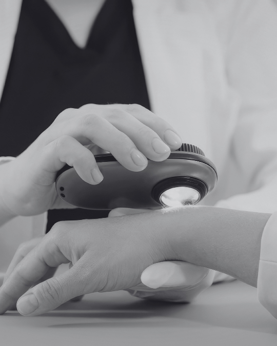 Close up of a woman getting her mole checked under a microscope