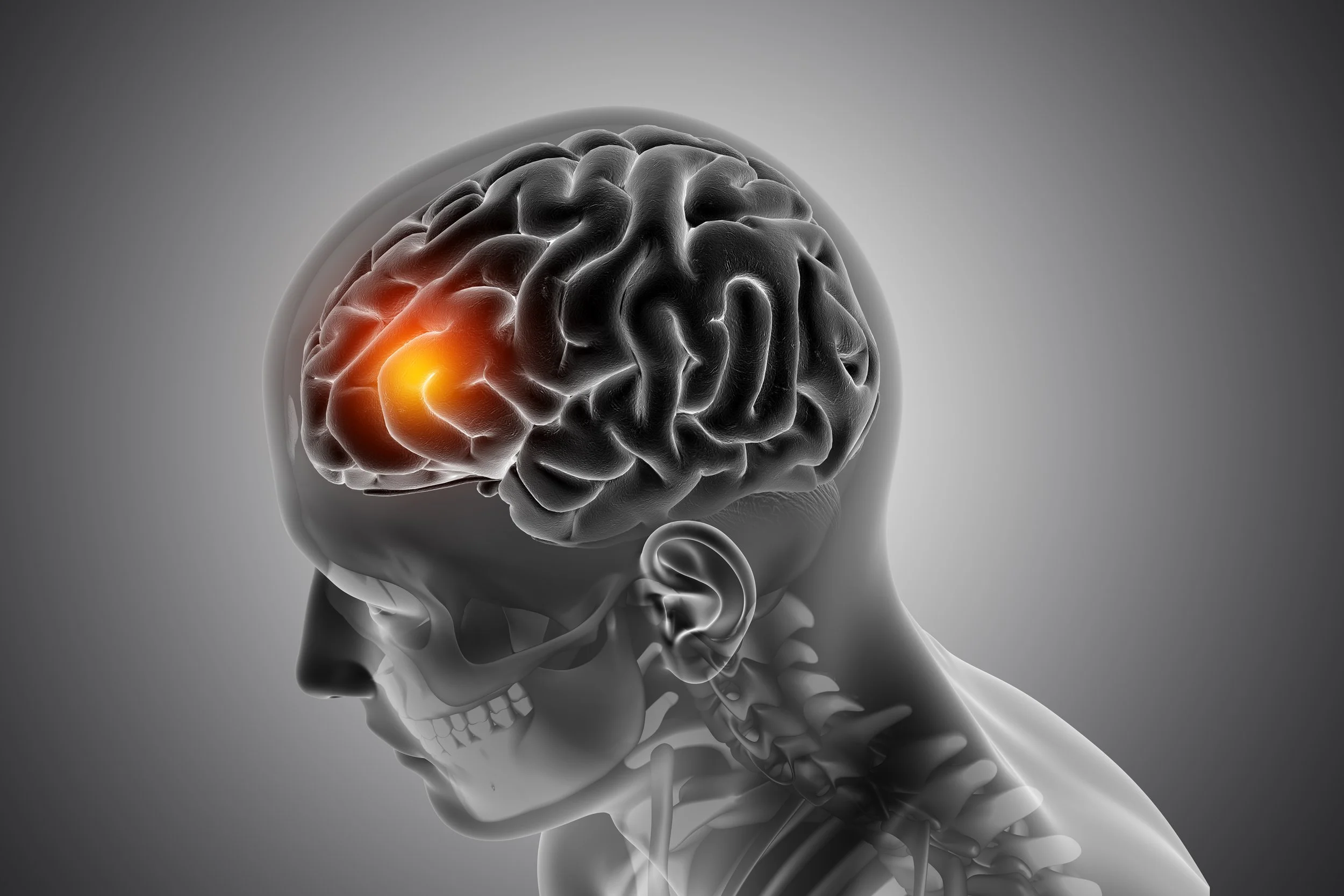How Your Brain Creates Pain- and Why That Matters