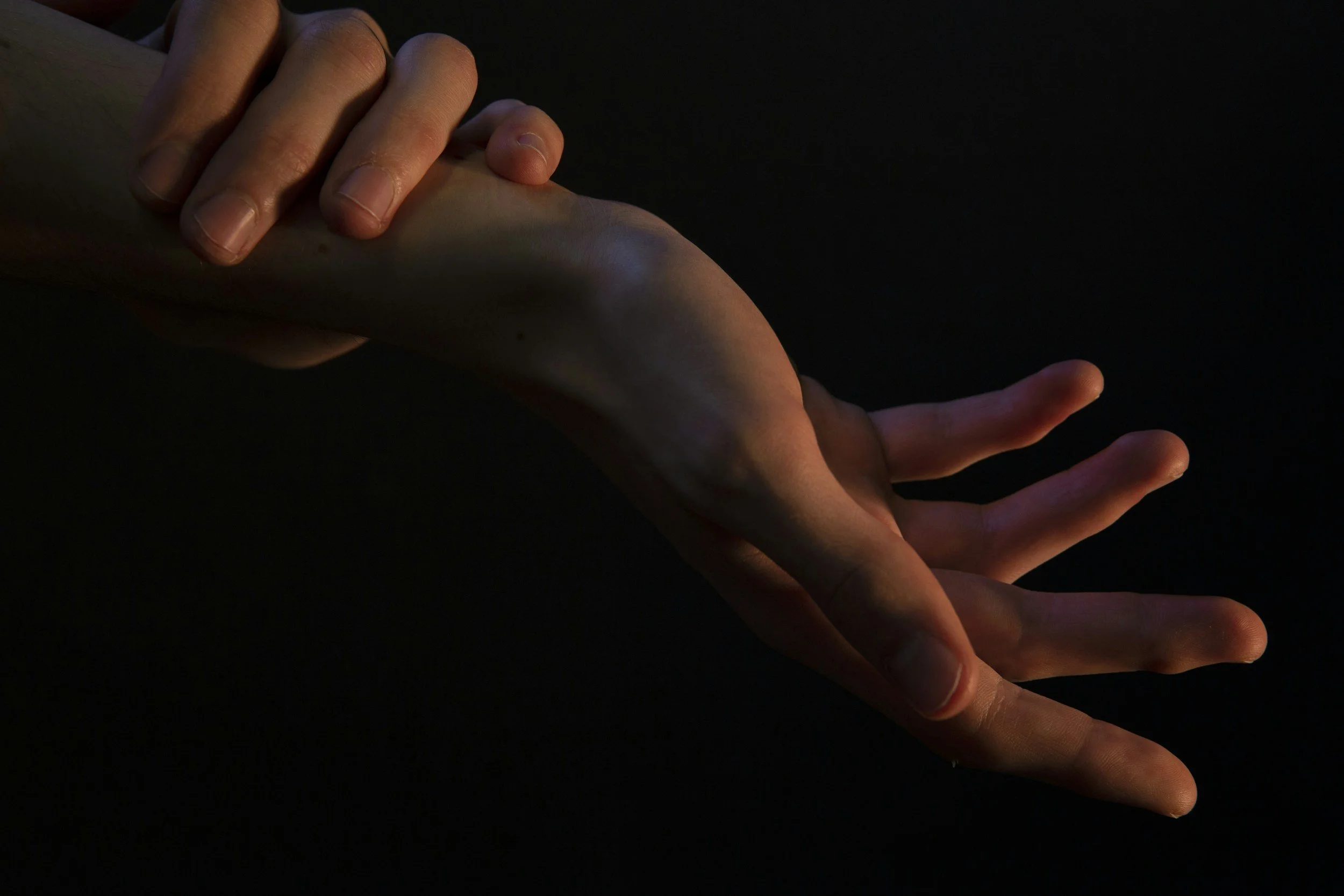 Unlocking Relief: Acupuncture for Carpal Tunnel Syndrome