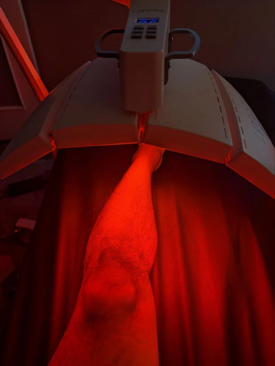 Red light therapy treatment on a patient’s leg