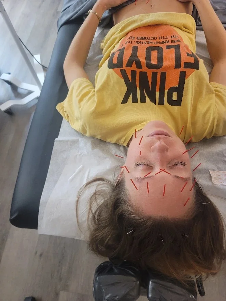 Patient relaxing during an acupuncture treatment