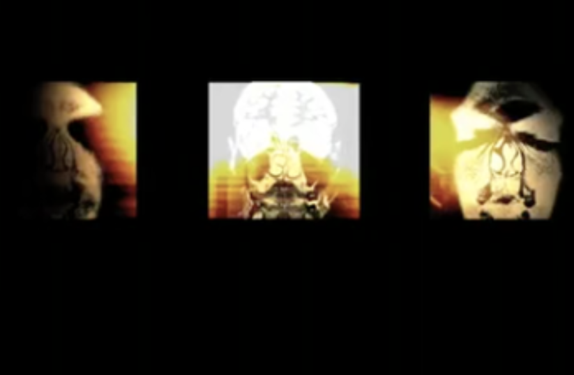 INTRA-AURA (2010)