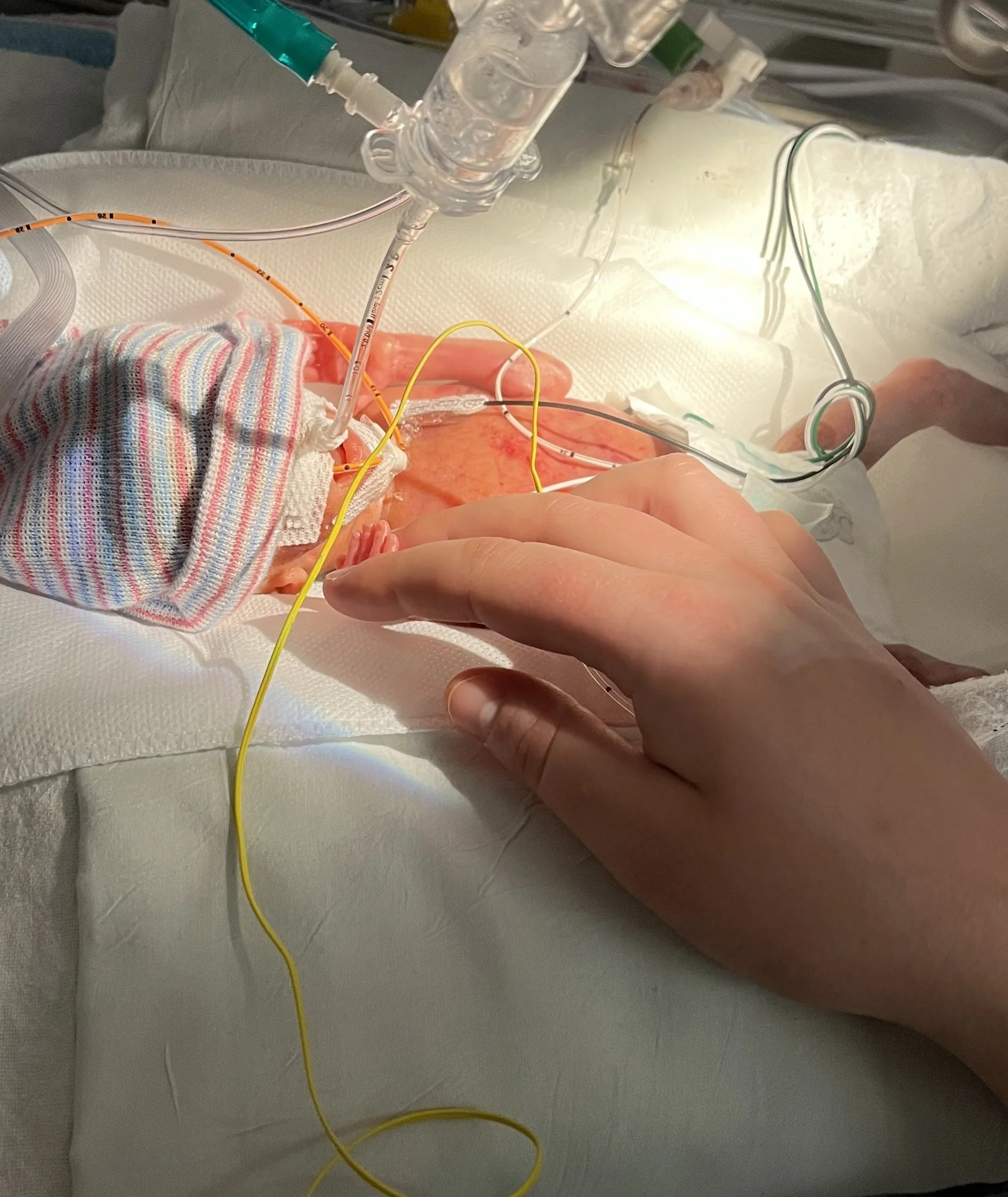 Close-up of an adult hand placing a hand on a newborn baby's tiny hand in a NICU incubator.