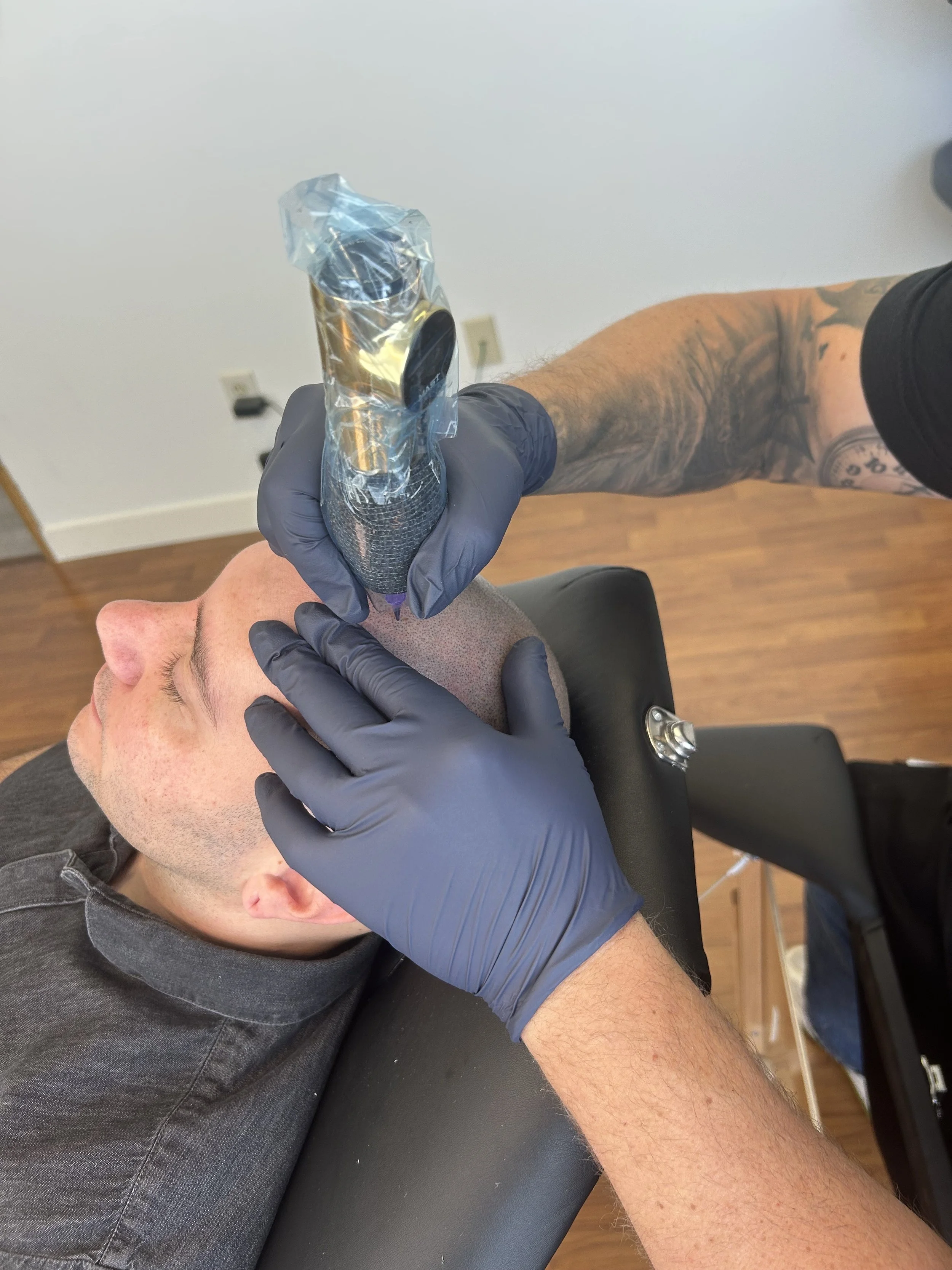 Scalp Micropigmentation (SMP) for Men
