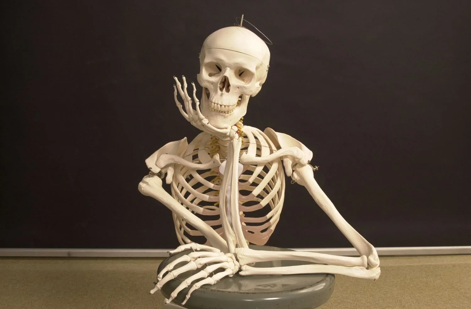 Protecting Your Bones: 8 Lifestyle Changes to Prevent Bone Loss