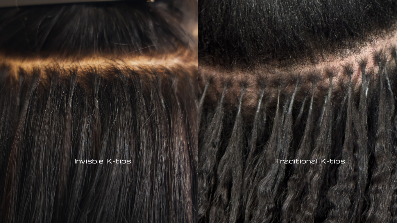 Traditional K-Tips vs. Invisible K-Tips — What's the Difference and Are You a Candidate?