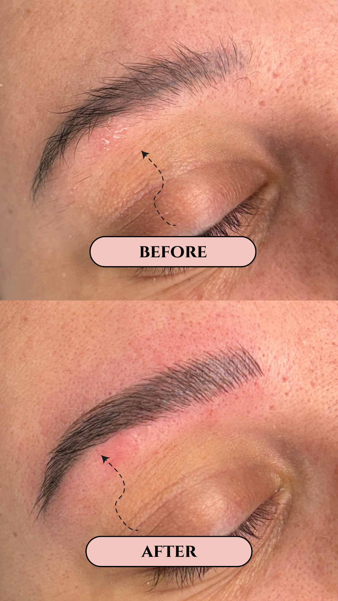 Sourcils avant-après