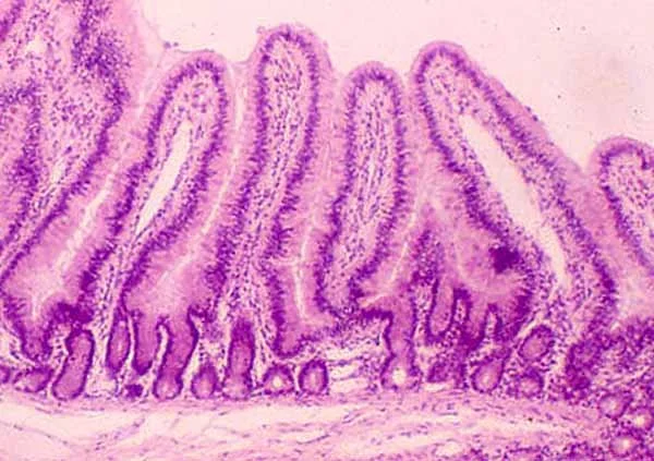 Gut lining + immune reactivity:  markers like zonulin, histamine, and DAO help us understand permeability (“leaky gut”), immune activation, and inflammatory overload.