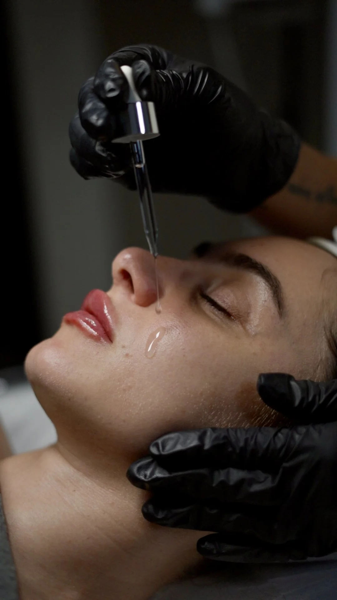 A person receives a cosmetic or skincare treatment with a dropper from a practitioner wearing black gloves.