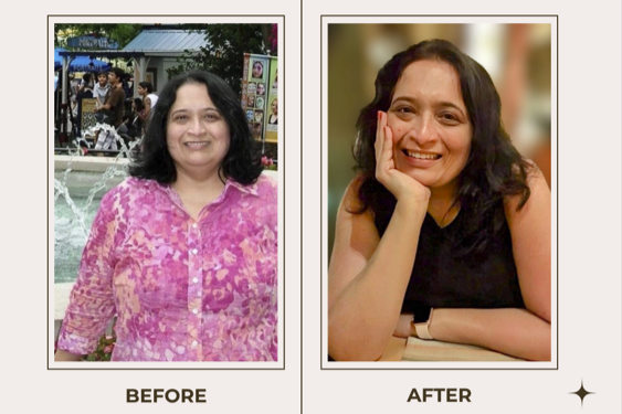 Side-by-side photos of Kruti Thakore, AWP, NBC-HWC, before and after a transformation. My 70-pounds weight-loss journey.