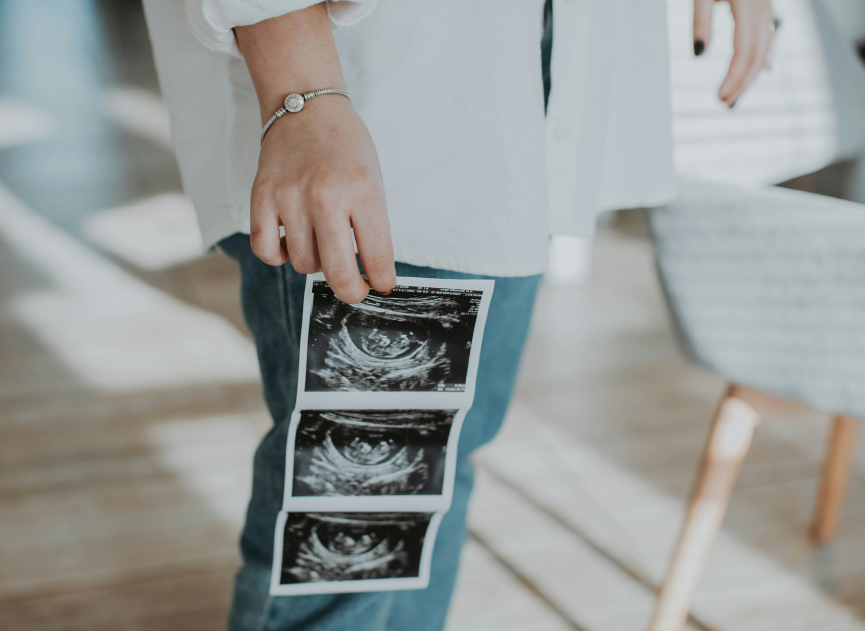 Person holding multiple ultrasound images in a casual setting.
