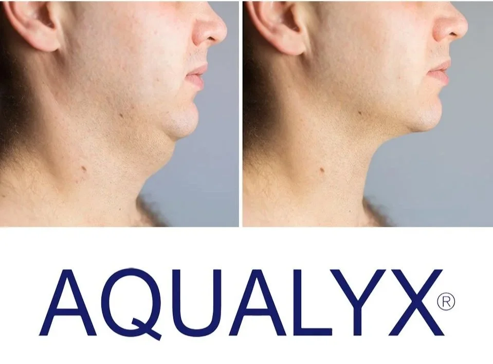 Before and after images showing the removal of a double chin with Aqualyx, a fat-dissolving treatment.  Not Lemon Bottle