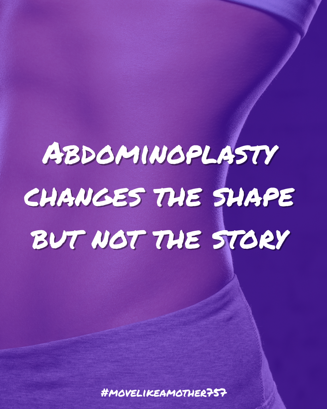 Abdominoplasty changes the shape but not the story