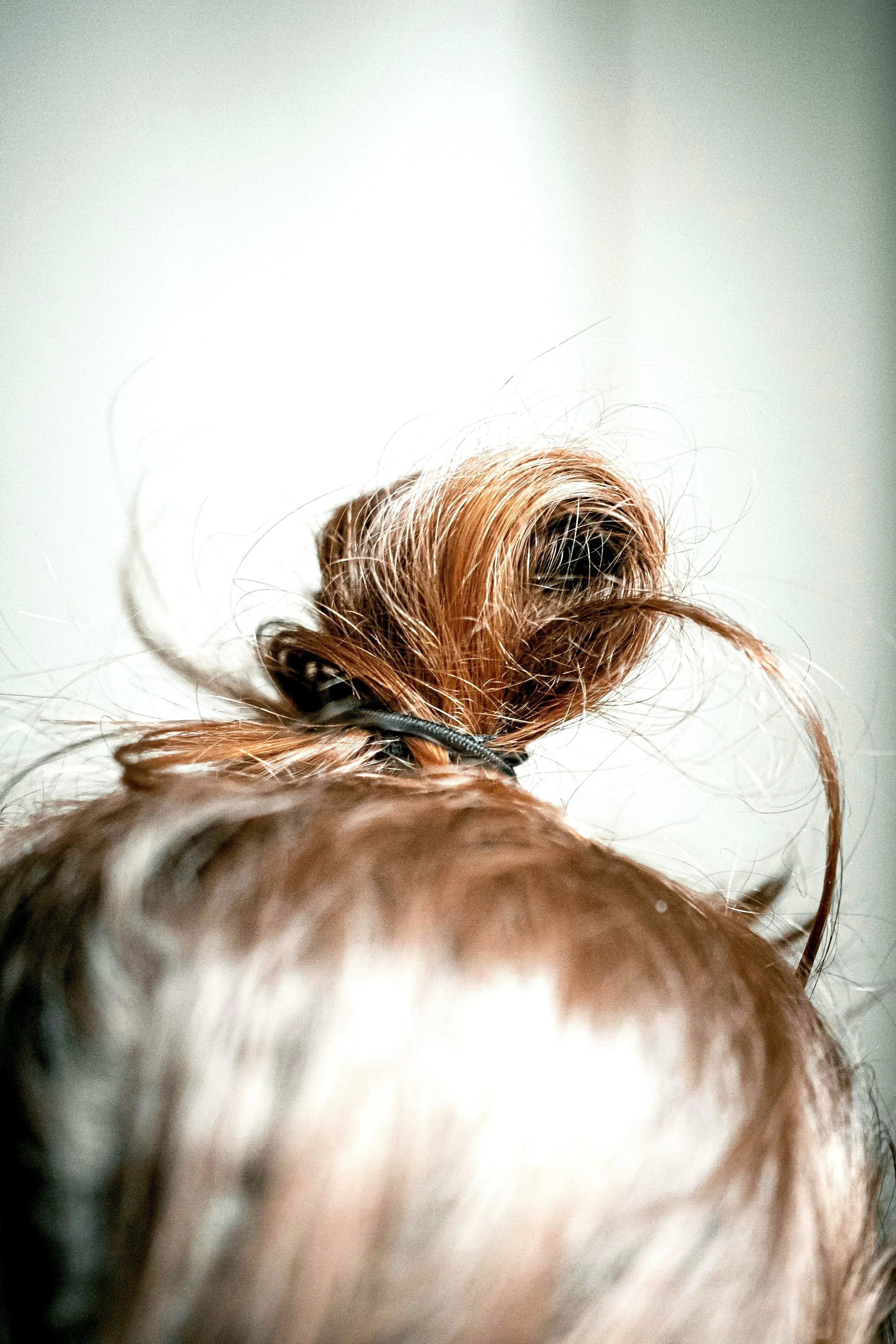 Ketamine Therapy for Trichotillomania: Breaking Free from Compulsive Hair Pulling When Traditional Treatments Haven't Worked