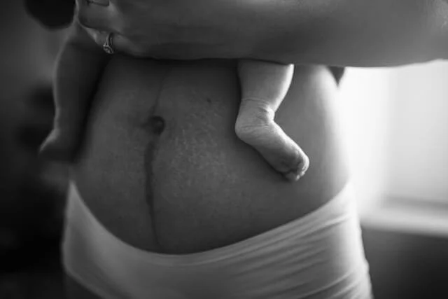 What is a doula and why do I need one? All you need to know.