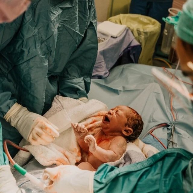 Preparing for a C-section: 10 things you can ask for (that you might not know about).